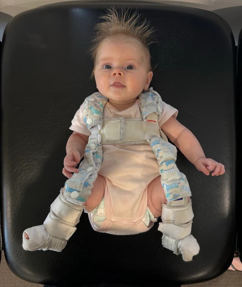 A baby fitted with a Pavlik harness